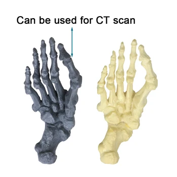 Два варианта типа Модель человеческого скелета Модель эктропиона большого пальца Модель коррекции вальгусной деформации